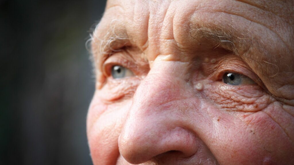 How-To-Prevent-Alzheimer's-Disease