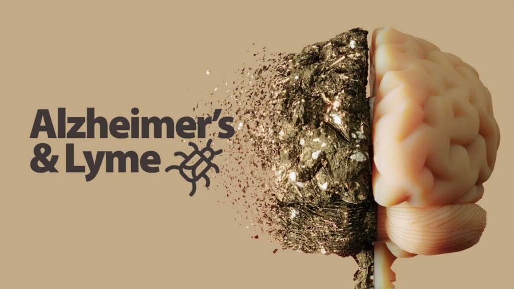 Alzheimers--Lyme-Brown