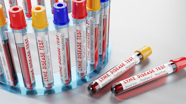Understanding Lyme Disease: The Burden, Diagnosis, and Controversy