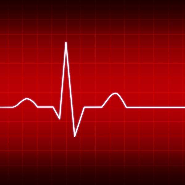 Heartbeat monitor with a red background showing a normal sinus rhythm, representing heart health and electrolyte balance.