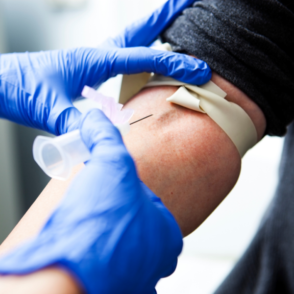 A nurse drawing blood for a test, representing advanced screening.