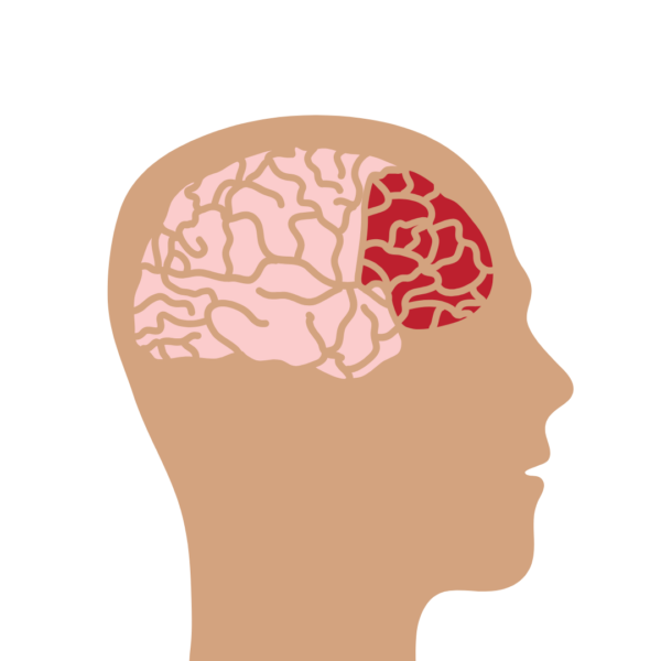 Illustration of a human head in profile with a red, inflamed section in the prefrontal cortex area, representing a brain affected by inflammation, poor diet, or stress — symbolizing impaired cognitive function and decision-making