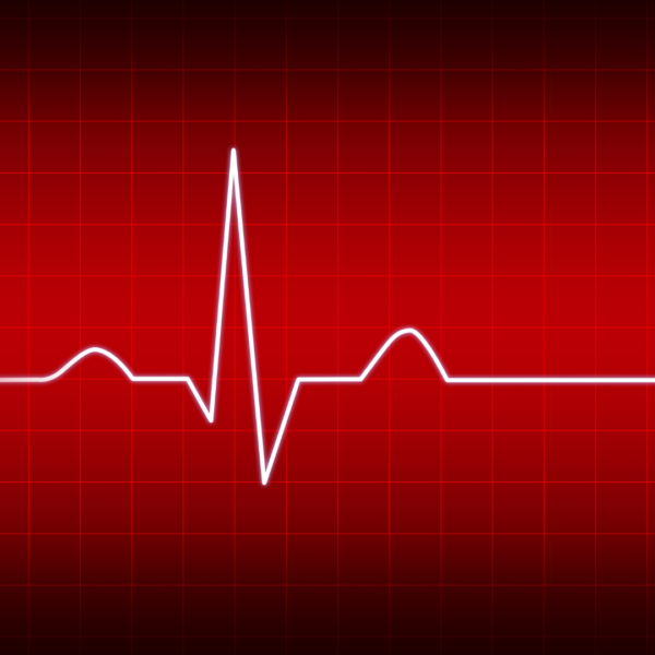 Heartbeat monitor with a red background showing a normal sinus rhythm, representing heart health and electrolyte balance.